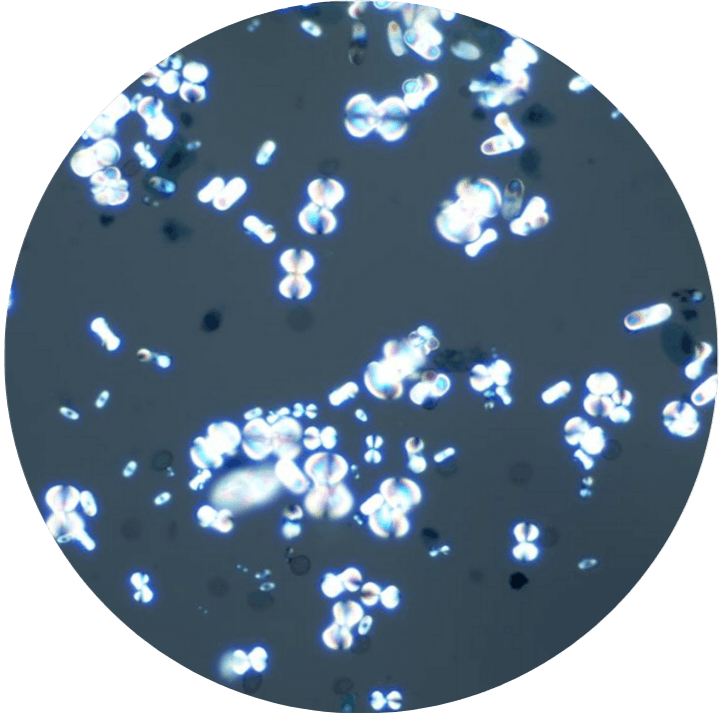 Calcium Oxalate