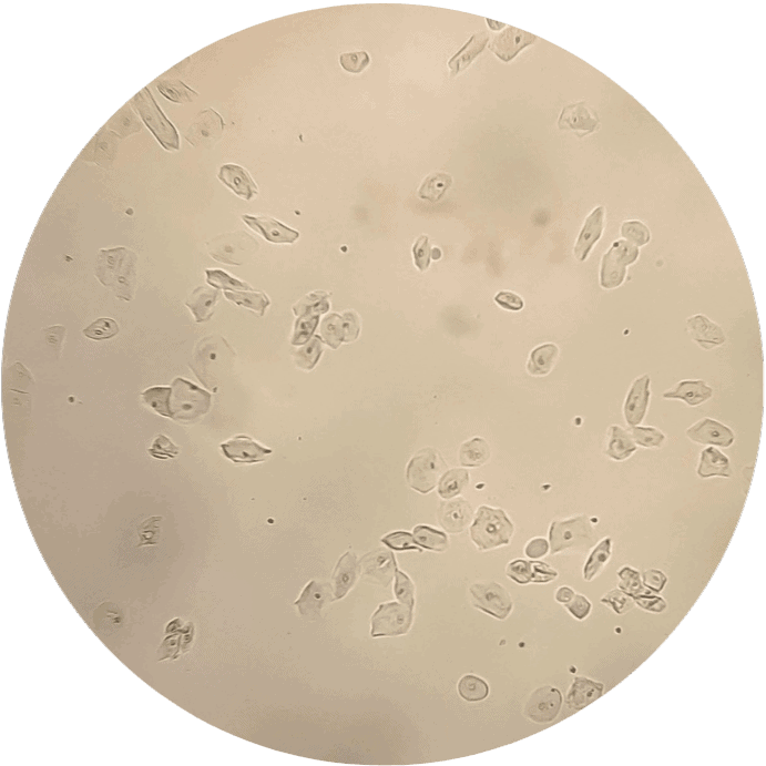 Epithelial Cells