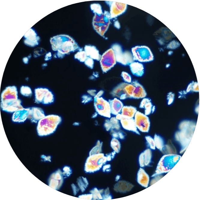 Uric Acid Crystals