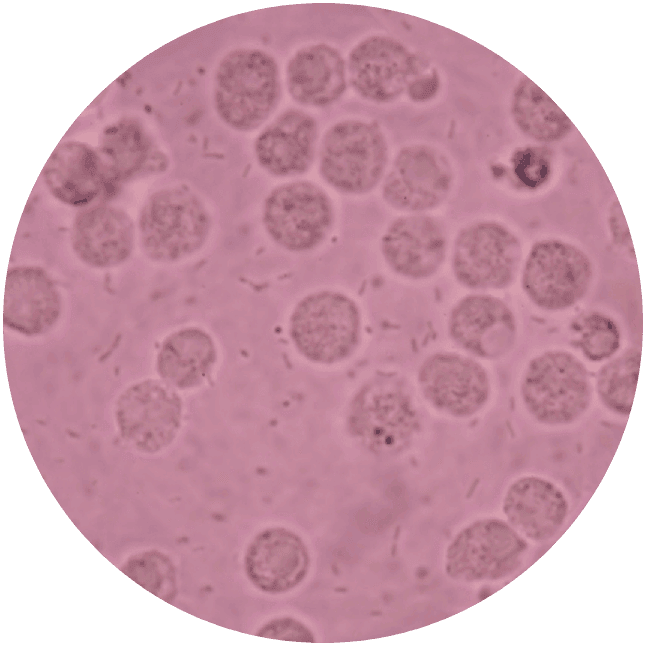 White Blood Cells